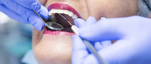 Best Broken or Cracked Tooth Emergency Dentist in Citronelle, AL